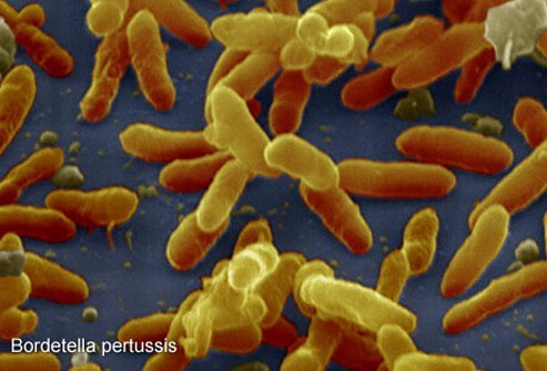 Bordetella pertussis is the bacteria that cause whooping cough.