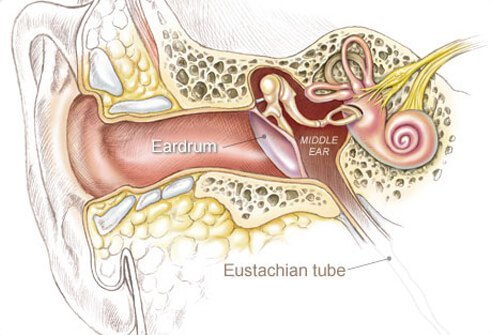Ear infections are very common in children and are caused by a dysfunction of the Eustachian tubes, the tubes that connect the inner ears to the throat and serve as a drain for any fluid that may collect there.