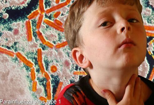 Croup is common in young children.