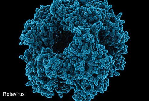 Rotavirus infection is responsible for significant morbidity and mortality in children in less developed countries where access to the rotavirus vaccine is limited.