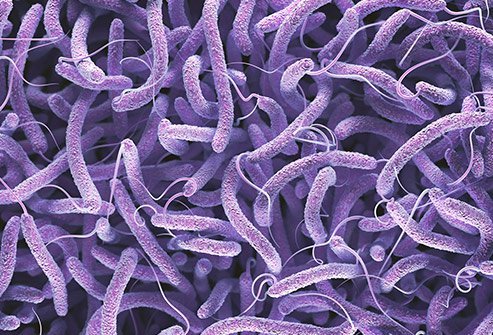 Cholera is a disease that causes foul-smelling diarrhea that looks like rice water.
