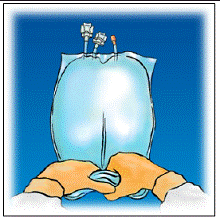 Slowly roll the container  - Illustration