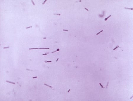  Picture of Clostridium tetani