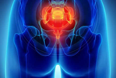 Coccydynia is tailbone pain that occurs at the tip of the tailbone between the buttocks.