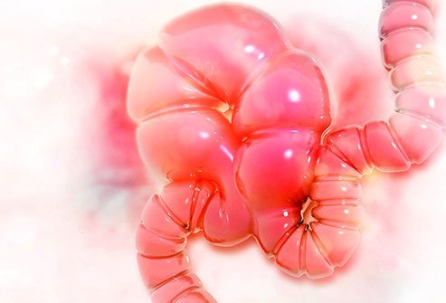 Pain and cramps are main symptoms