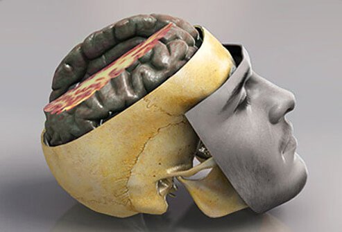 Although the brain is protected by tough bone (skull) and padding (membranes), it can still be injured.