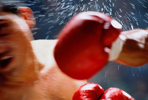 Traumatic brain injuries result from either a blow to the head that does not penetrate the skull (closed head injury) or from an object penetrating through the skull into brain tissues.