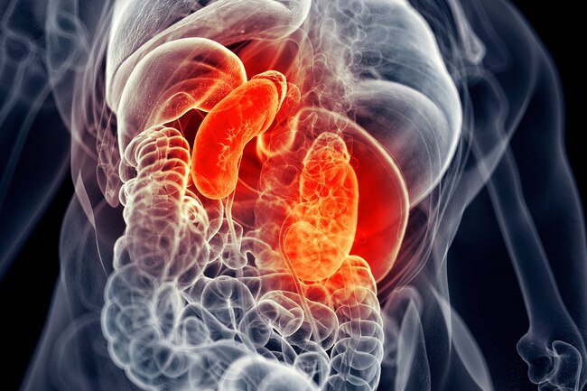 Inflamed kidneys may make it harder for kidneys to eliminate waste and may lead to bloody urine.