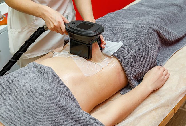 Cool sculpting or cryolipolysis is a nonsurgical or noninvasive method for body contouring. Cool sculpting or cryolipolysis is a nonsurgical or noninvasive method for body contouring.
