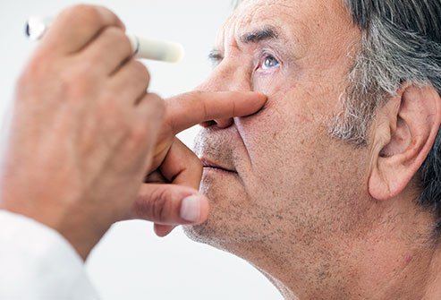 With prompt treatment, most corneal ulcers improve with minimal adverse effect on vision.