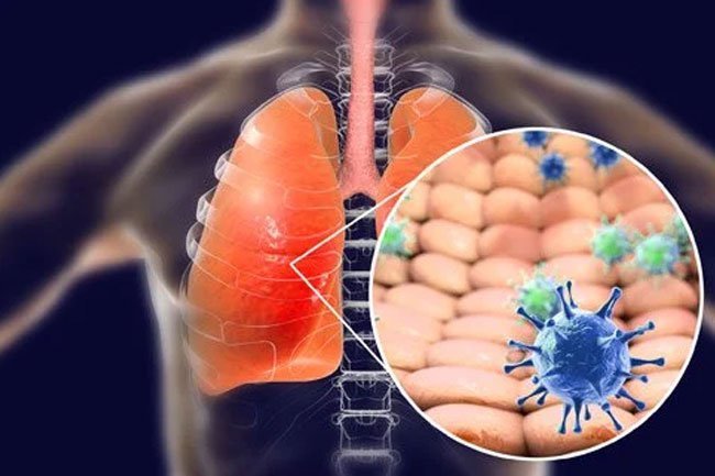 This novel coronavirus was initially named 2019-nCoV and was also called Wuhan coronavirus because the first infected people came from Wuhan City, Hubei Province in China. Later known as COVID-19 (SARS-CoV-2).