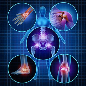 A graphic illustration of various joint pain locations.