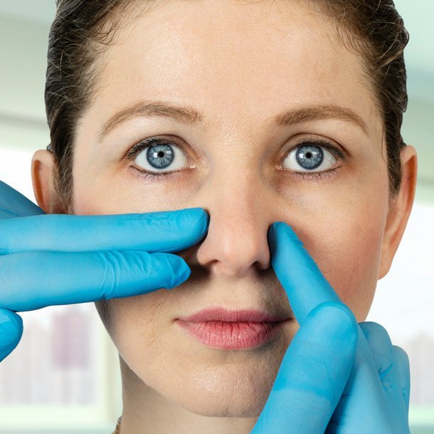 Nasal Deviated Septum