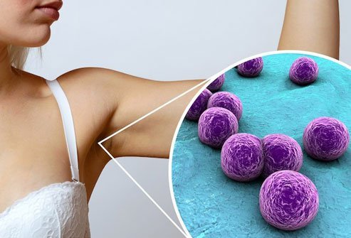 Antiperspirant alters your armpit microbiome. 