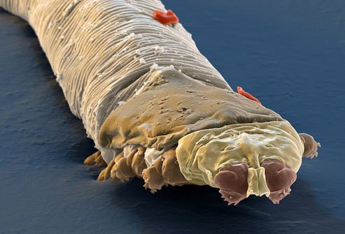The number of face mites you carry increases with age. 