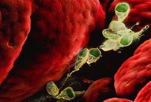 Giardia lives in infested waters. 