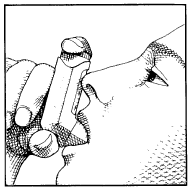 Instructions for the Patient - illustration 2 Instructions for the Patient - illustration 2