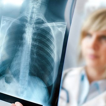 Symptoms alone often lead to a croup diagnosis in children when evaluated by a health care provider.