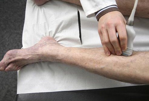 Photo of sonography of tibial arteries.