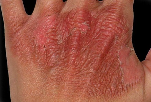 The skin has an important role to play in the fluid and temperature regulation of the body.
