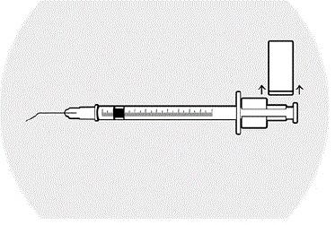In a single slow motion, inject 0.005 mL of the drug material behind the iris in the inferior portion of the posterior chamber - Illustration In a single slow motion, inject 0.005 mL of the drug material behind the iris in the inferior portion of the posterior chamber - Illustration
