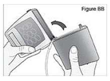 Attach the new DUOPA cassette to the pump - Illustration