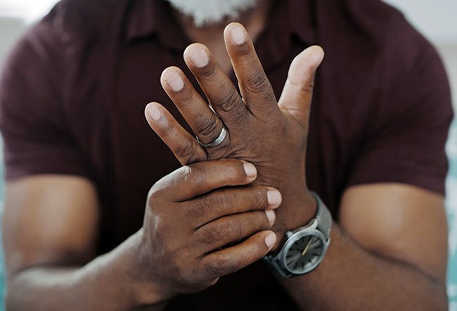 arthritis in hands