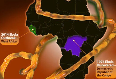 Ebola is a viral hemorrhagic (bleeding) illness that has a high fatality rate.