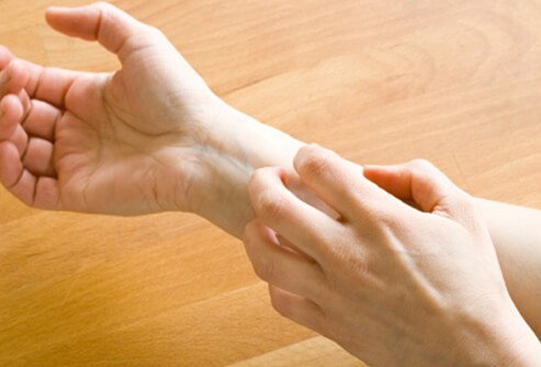 Intense itching is often the first symptom most people experience with eczema.