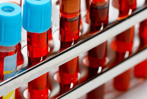 Many lab tests can be helpful in diagnosing male sexual problems.