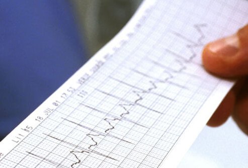 Erectile dysfunction can be a warning sign of serious underlying disease.