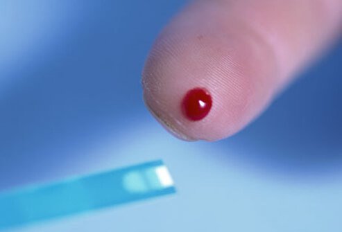 The link between underlying chronic disease and erectile dysfunction is most striking with diabetes. 