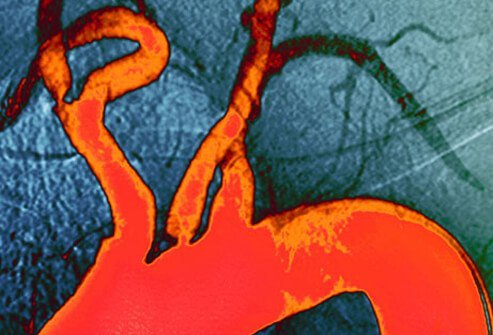 A complete blood lipid panel helps assess cardiovascular health. 