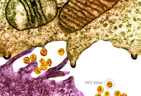 The virus infects CD4 T cells of the immune system.  