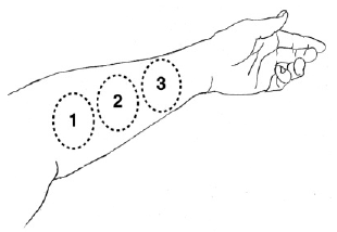 Increasing the dose - Illustration