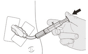 Slowly push the plunger all the way down to
give the full dose of EVRYSDI - Illustration