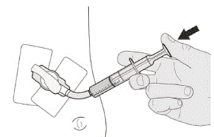 Flush the gastrostomy tube with 10 mL to 20 mL
of water right after giving the prescribed dose of
EVRYSDI - Illustration
