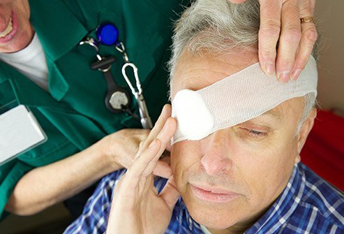 An optometrist can remove a foreign body from the eye under certain circumstances. An optometrist can remove a foreign body from the eye under certain circumstances.
