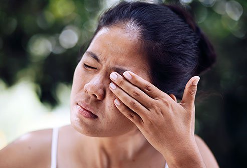ocular rosacea treatment