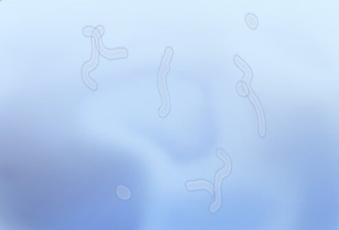 Floaters are caused by aging changes in the vitreous jelly of the eye. 