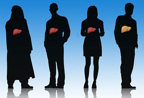 Fatty liver disease is more common than you might realize. 