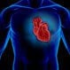 Abdominal Aortic Aneurysm