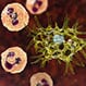 Acanthamoeba