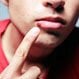 Are Cold Sores (Fever Blisters) Contagious?