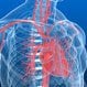 Congestive Heart Failure (CHF)