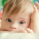 What Chromosome Causes Down Syndrome?