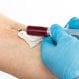 Is Hepatitis A Contagious?