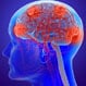 How Do You Stop Multiple Seizures?