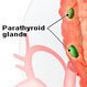 Hypoparathyroidism