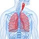 What Is Idiopathic Pulmonary Fibrosis (IPF)?
